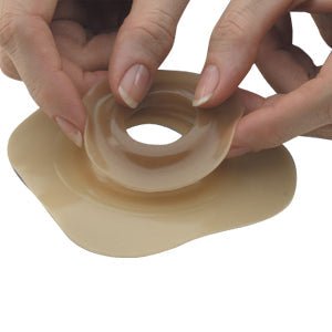 Skin Barriers & Ostomy Baseplates for Secure Stoma Protection - American Hospital Supply