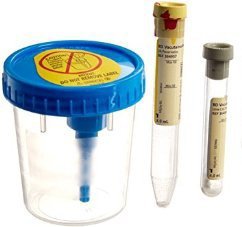 BD Vacutainer® Urine Specimen Collection Kit - American Hospital Supply