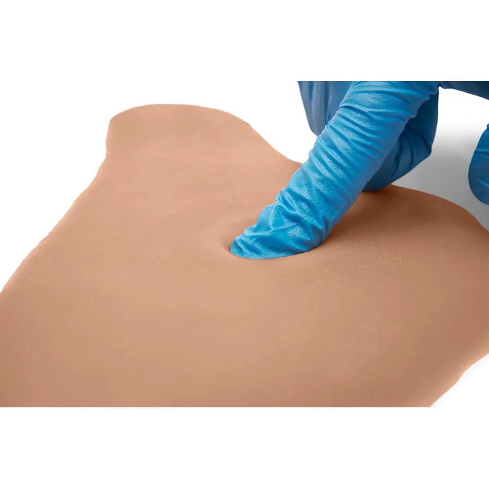 CAE Medicor Pitting Edema Sticky Pads - American Hospital Supply