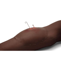Sticky Wound Foreign Body: Fish Hook
